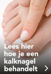 Kalknagels behandelen