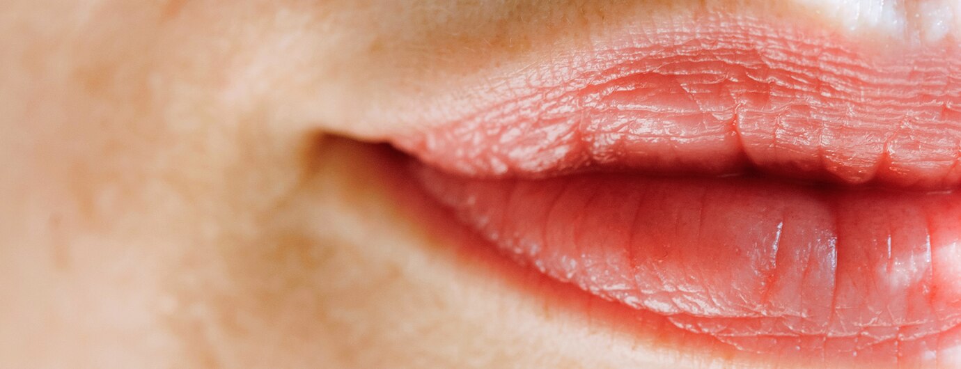 (Extreem) droge lippen: tips & adviezen