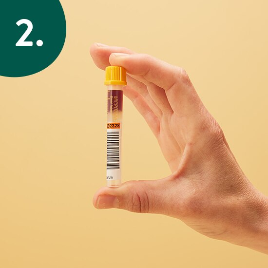 Sample afnemen