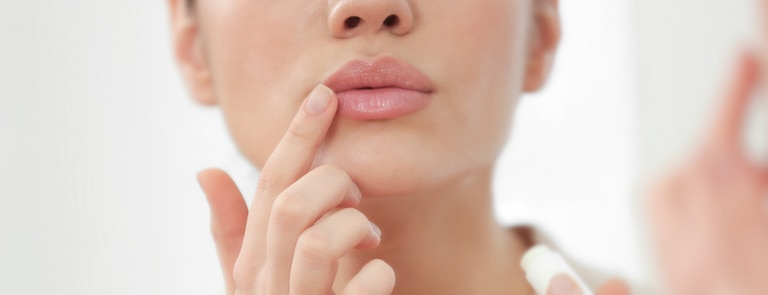woman applying hygienic lip balm to cold sore