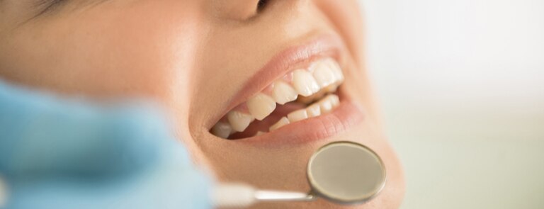 how to keep teeth healthy