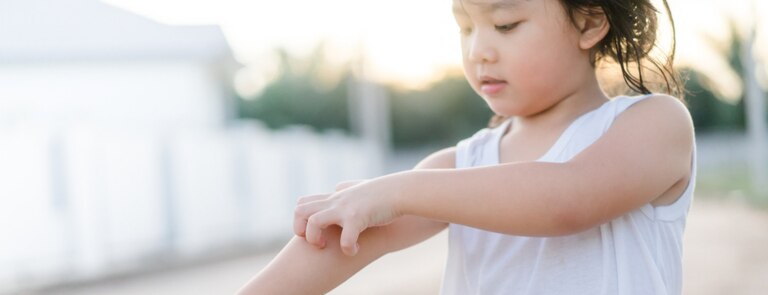 stressed child with eczema scratching skin on arm