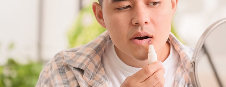 man applying cream to cold sore on lip