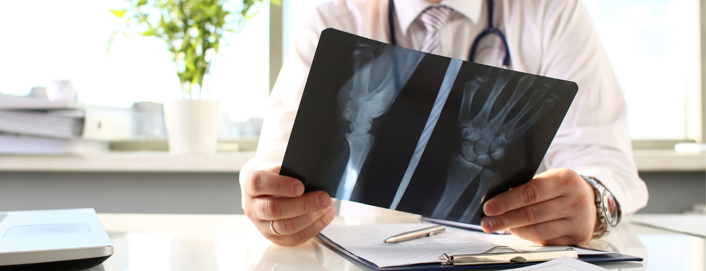 osteoporosis x-ray