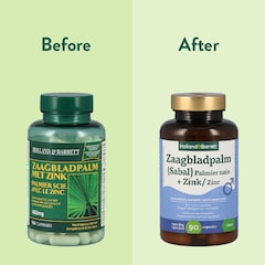 Zaagbladpalm (Sabal) + Zink - 90 capsules