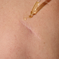 Image 3 for Scar & Stretchmark Oil 50ml