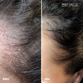 Image 5 for 3-Seaweed Scalp Mud 150ml