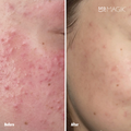 Image 3 for Mild Exfoliant