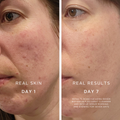 Image 4 for Clarifying Rescue Serum 30ml