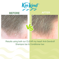 Image 4 for CLEAR my head! Anti Dandruff Conditioner Bar 40g