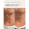 Image 2 for Retinol Reboot Exfoliating Body Treatment 120ml