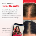 Image 3 for HAIRtamin Advanced Formula 30 Capsules