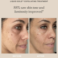 Image 5 for Liquid Gold With 5% Glycolic Acid 100ml