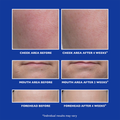Image 3 for Retinol Fusion Pm Night Serum 30ml