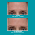 Image 5 for Peptide Skinjection Amplified Wrinkle-Fix Serum 30ml