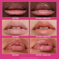 Image 5 for Instant Firmx Lip Filler 10ml