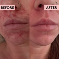 Image 3 for Migh-Migh-Tea Moisture Skin Recovery Balm 140g