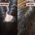 Image 3 for Rich Roots Hair & Scalp Growth Oil 100ml