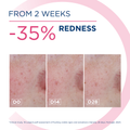 Image 2 for Sensibio AR+ Cream Anti-Redness Moisturiser 40ml