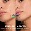Image 3 for Sébium Kerato+ Gel-Cream Gentle Anti-Blemish Moisturiser 30ml