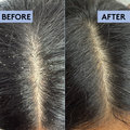 Image 3 for Scalp-Eaze Exfoliate & Clarify Scalp Scrub