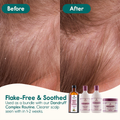 Image 3 for Dandruff Complex Conditioner 300ml