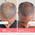 Image 4 for Stylpro Root Renew Hair Brush