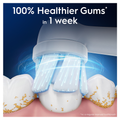 Image 3 for Oral-B iO Series Gentle Care, Original Brush Heads, for Sensitive Gums, 4