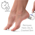 Image 3 for Go Smooth 60 Second Foot File Hard Skin Remover