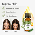 Image 4 for Rosemary Essential Oil 15ml – Natural Hair, Scalp & Aromatherapy Oil