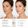Image 4 for Blemish Prone 2% Salicylic Acid, 3% Centella Asiatica Facial Serum 30ml