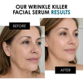 Image 4 for Wrinkle Killer Anti-Ageing Facial Serum 30ml