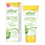 Alba Botanica Acne Oil Control Lotion 57g