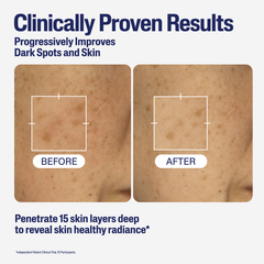 Image 5 for Healthy Radiance Brightening Niacinamide Serum 30ml