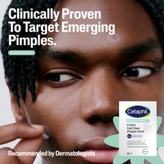 Image 4 for Gentle Clear Pimple Patches with Salicylic Acid 24 Pack