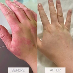 Image 5 for Caring Skin Fix 50ml