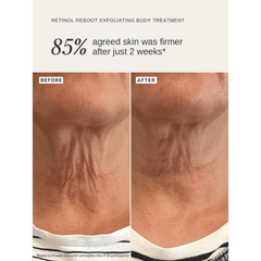 Image 2 for Retinol Reboot Exfoliating Body Treatment 120ml
