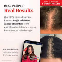 Image 5 for HAIRtamin Advanced Formula 30 Capsules
