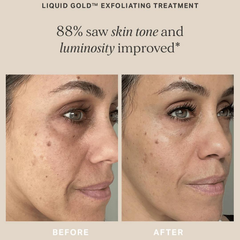 Image 5 for Liquid Gold With 5% Glycolic Acid 100ml