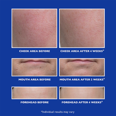 Image 3 for Retinol Fusion Pm Night Serum 30ml