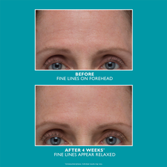 Image 5 for Peptide Skinjection Amplified Wrinkle-Fix Serum 30ml