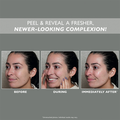 Image 3 for Firmx Peeling Gel 100ml