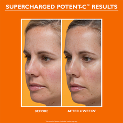 Image 5 for PTR Potent-C Power Moisturizer 50ml