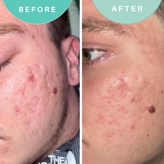 Image 3 for Soothe Operator Soothing Moisturiser
