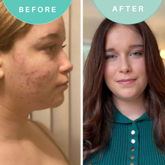 Image 3 for Best Cleanse Forever  Cleansing Face Wash