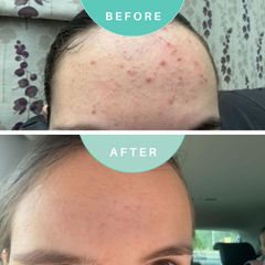 Image 4 for Best Cleanse Forever  Cleansing Face Wash