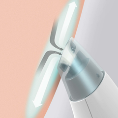 Image 2 for Homedics Refresh Hydradermabrasion
