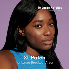 Image 4 for Breakout Patch Classic XL