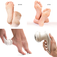 Image 4 for 60 Second Spa Pedi Hard Skin Remover Electric Foot File