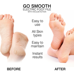 Image 5 for Go Smooth Electric Foot File Hard Skin Remover with Vacuum Action